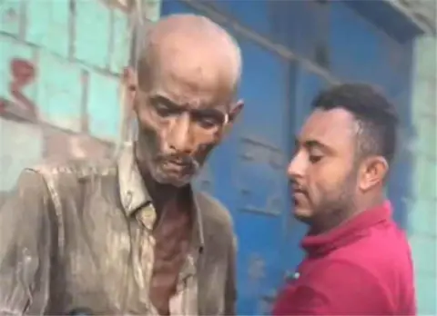 نداء إلى أبناء مصر.. طبيب عظام شهير بالحديدة يعاني من اعتلال نفسي ومناشدات عاجلة للتعرف عليه لنقله إلى وطنه - [فيديو]